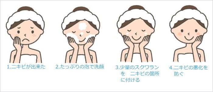 ニキビ,予防,ケア